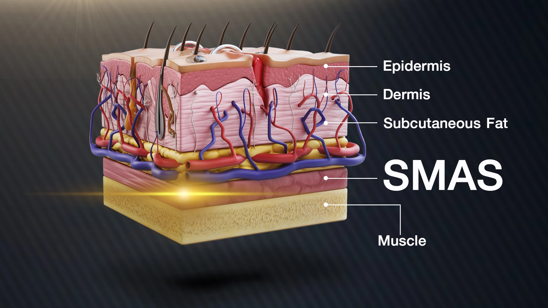 หลักการทำงาน ultraformer iii