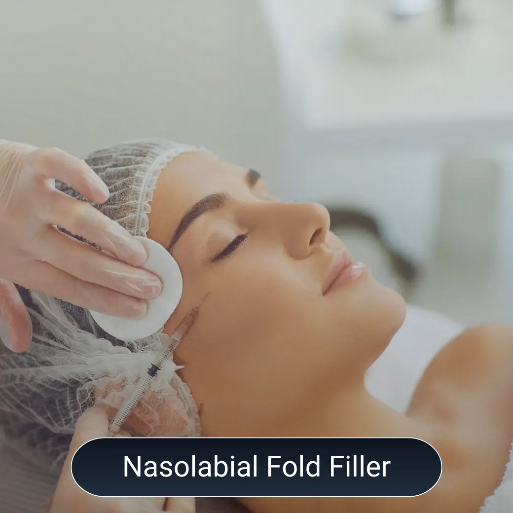 Nasolabial Fold filler