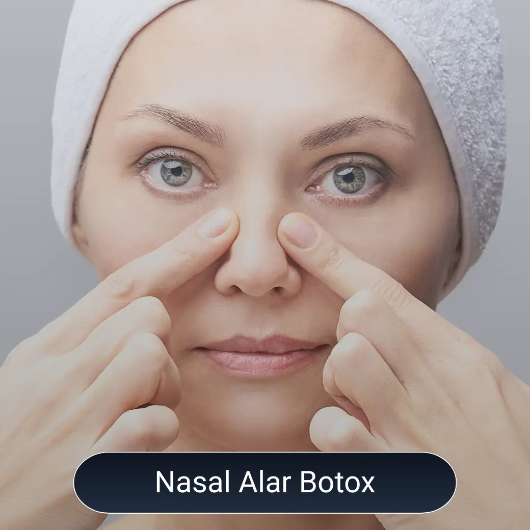 nasal alar botox