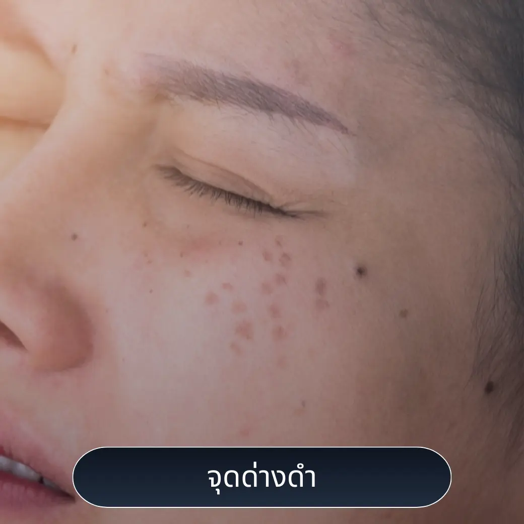 จุดด่างดำ