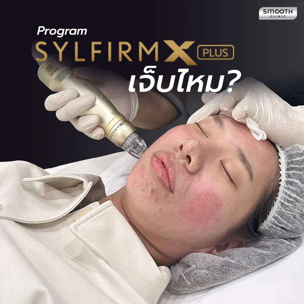 Sylfirm X Plus เจ็บไหม?