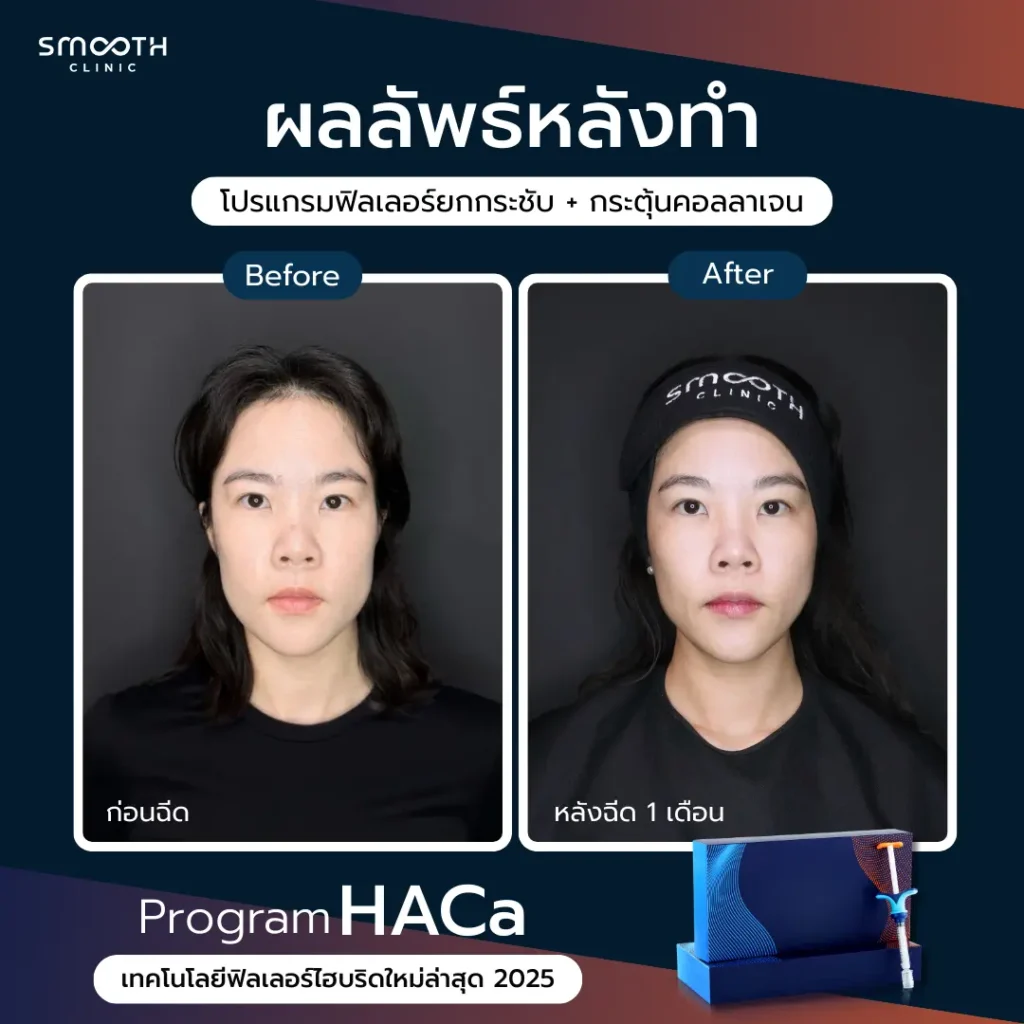 รีวิว bio harmonyca 1