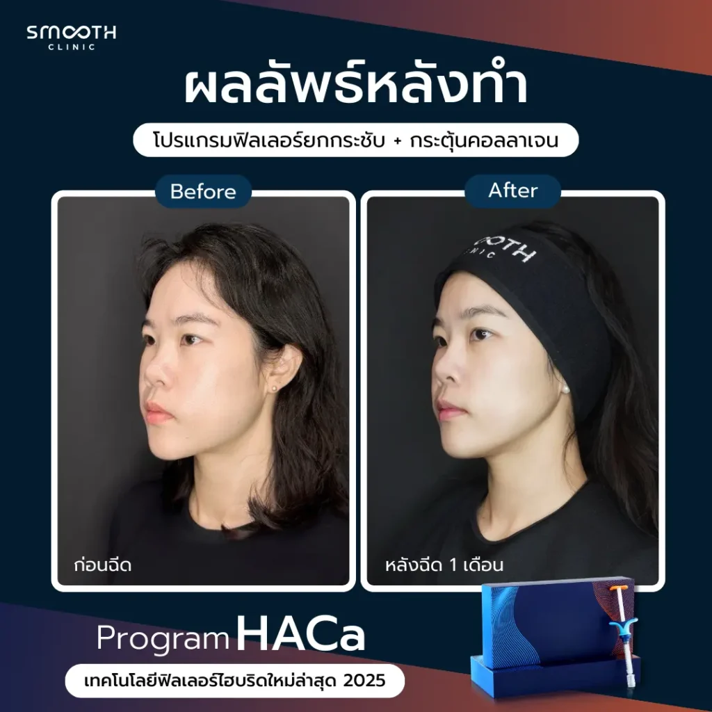 รีวิว bio harmonyca 2
