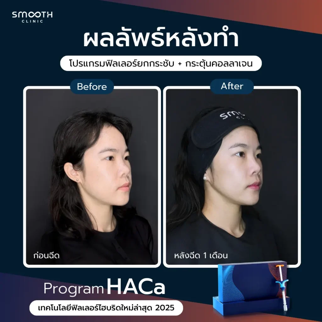 รีวิว bio harmonyca 3