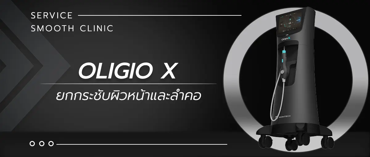 Smooth service Oligio x D