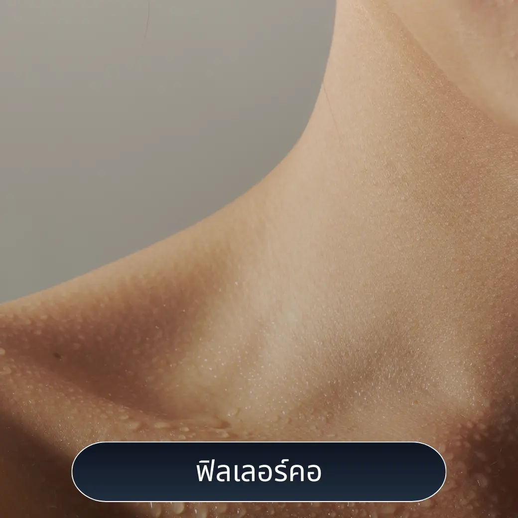 ฟิลเลอร์คอ