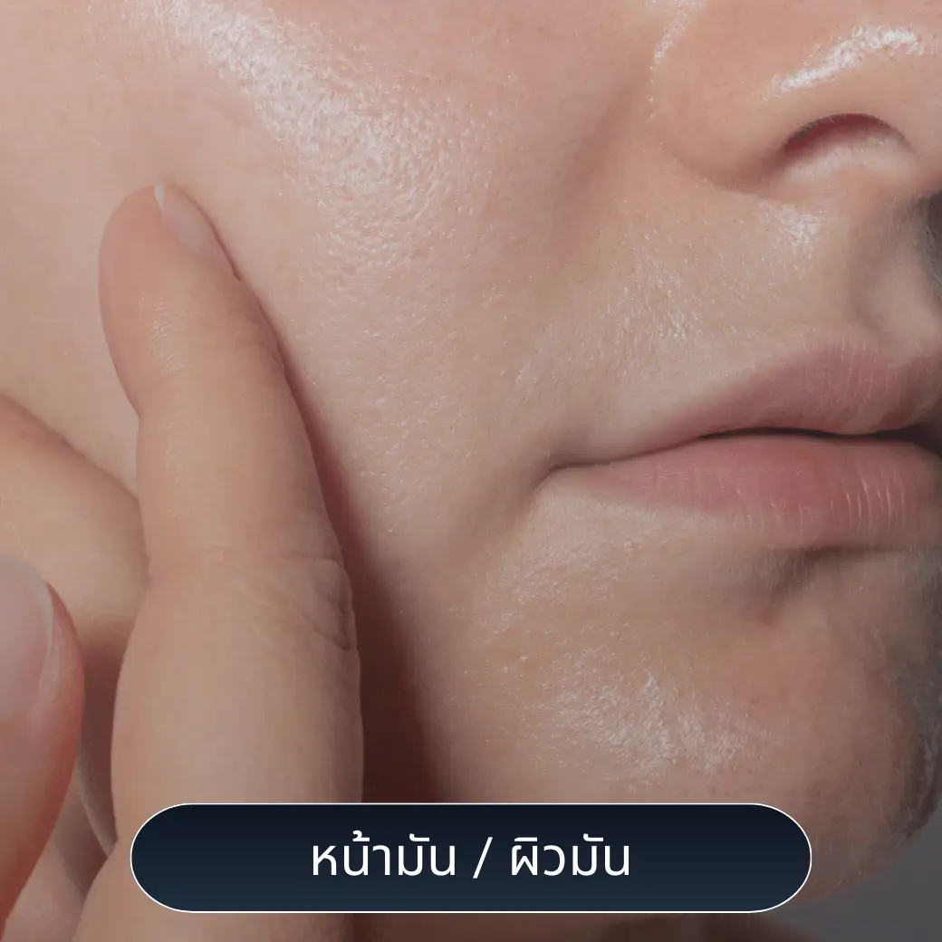 หน้ามัน ผิวมัน