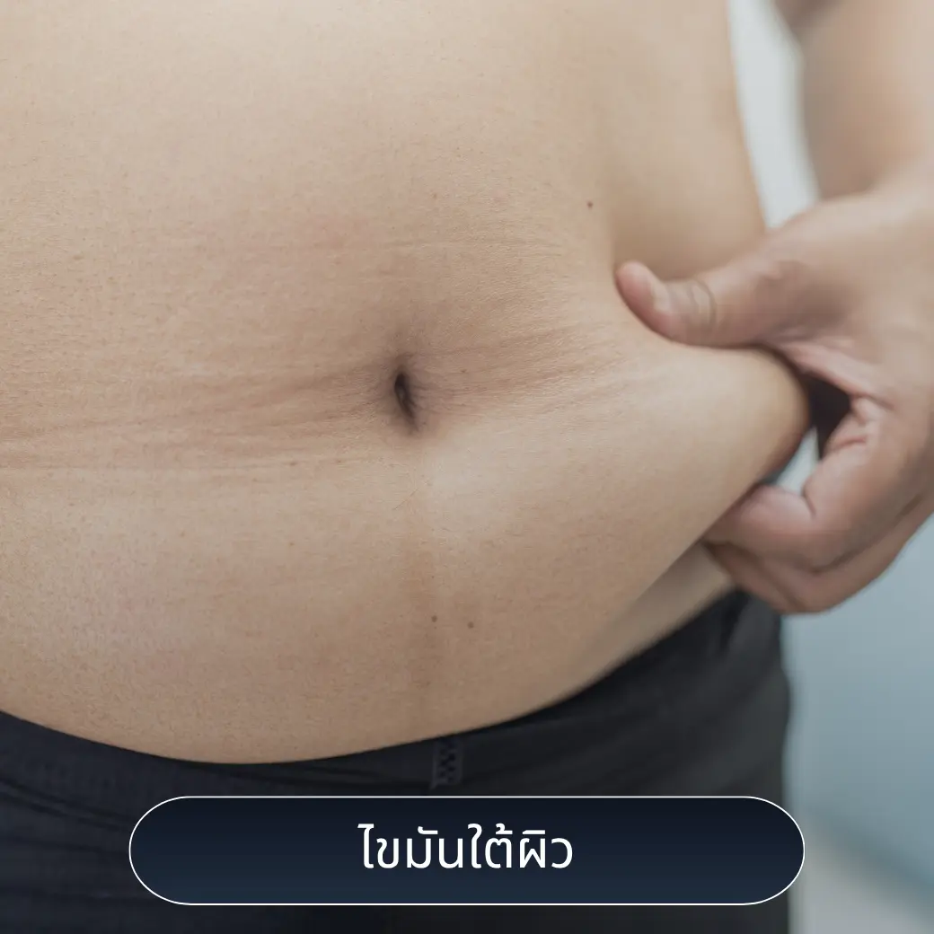 ไขมันใต้ผิว