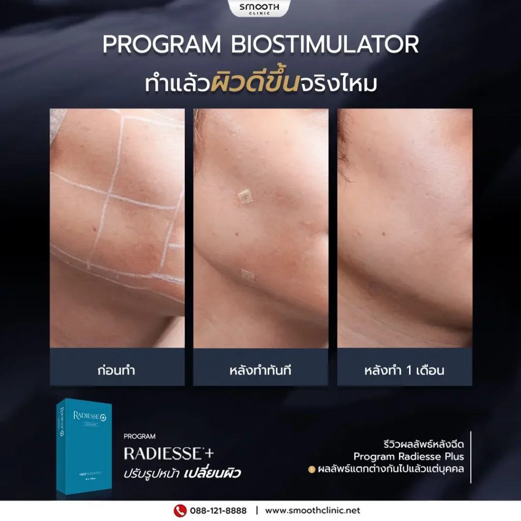 review q1 26 biostimulator 1