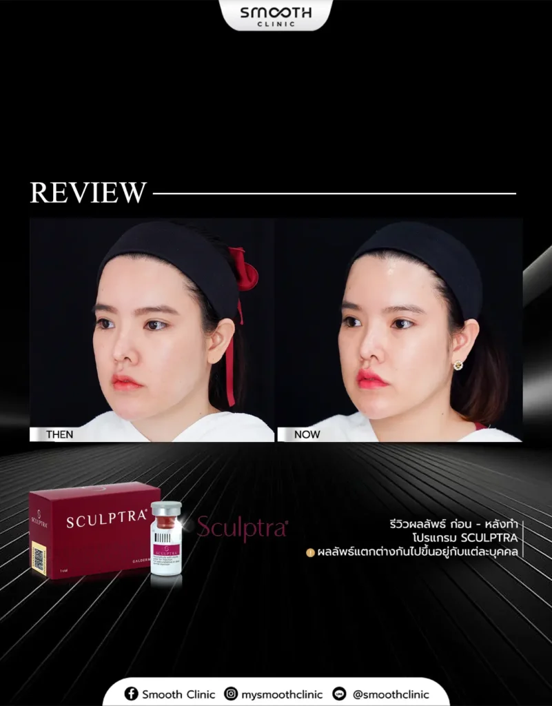 review q1 26 biostimulator 10