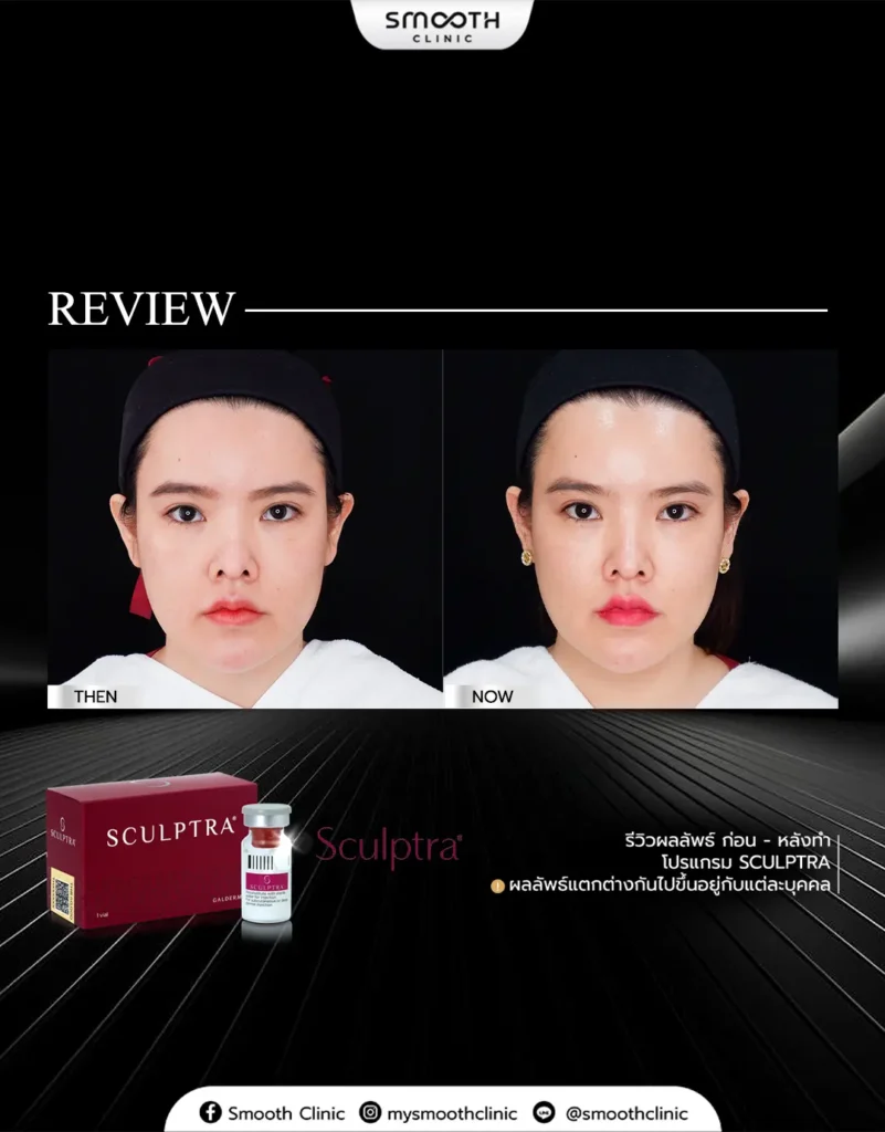 review q1 26 biostimulator 11