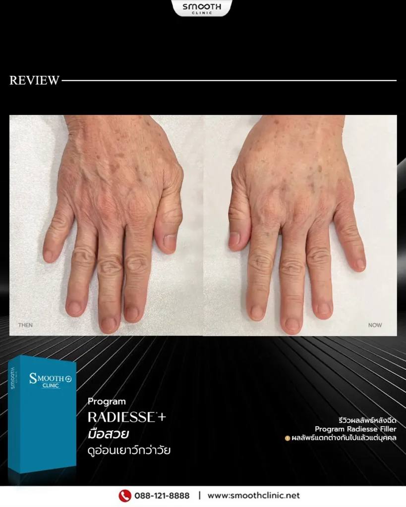 review q1 26 biostimulator 12