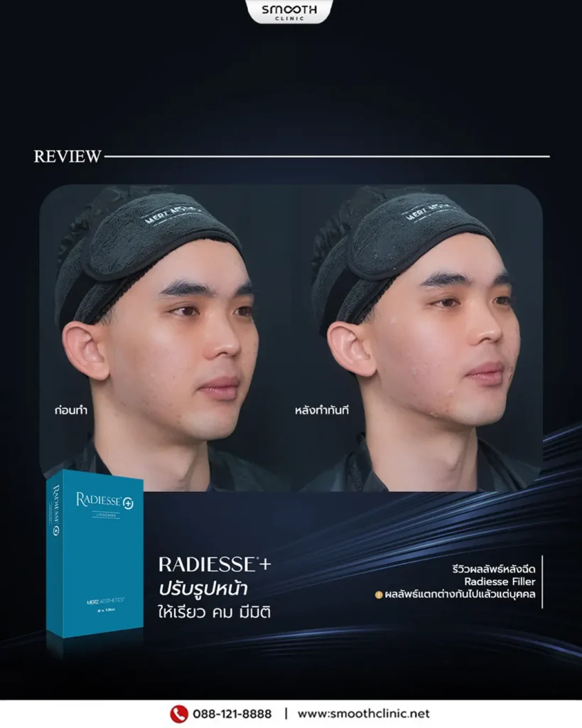 review q1 26 biostimulator 13