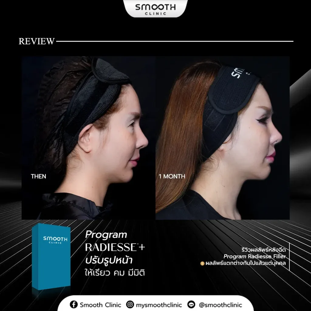 review q1 26 biostimulator 4