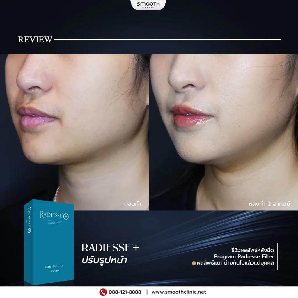 review q1 26 biostimulator 5