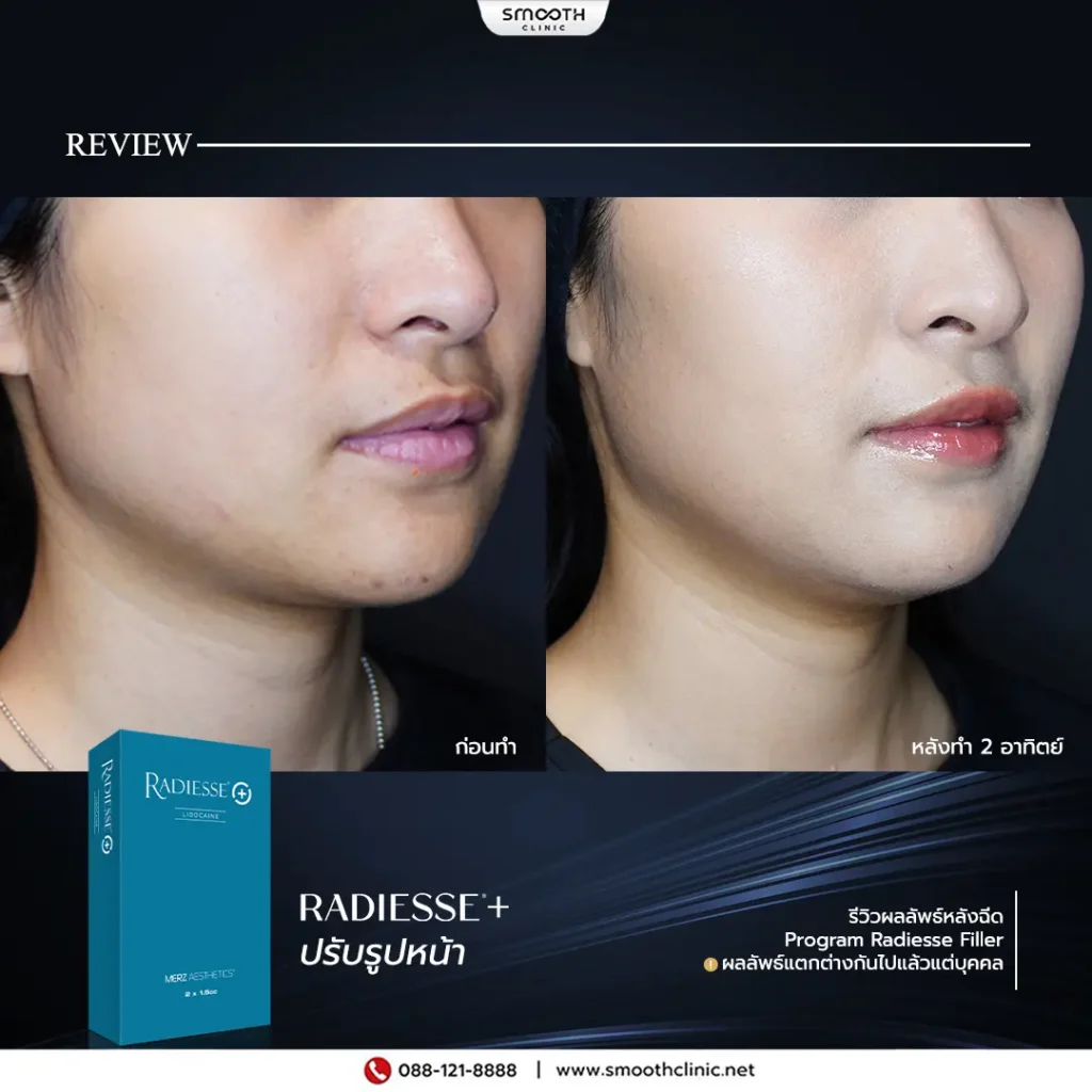 review q1 26 biostimulator 6