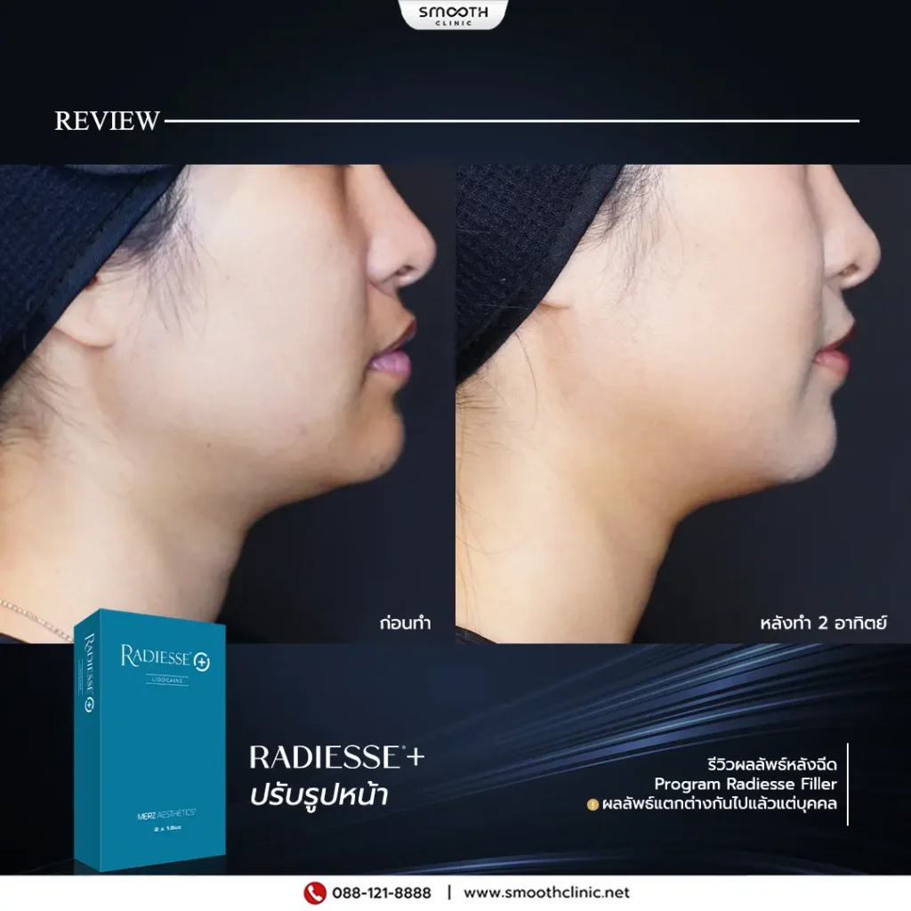 review q1 26 biostimulator 7