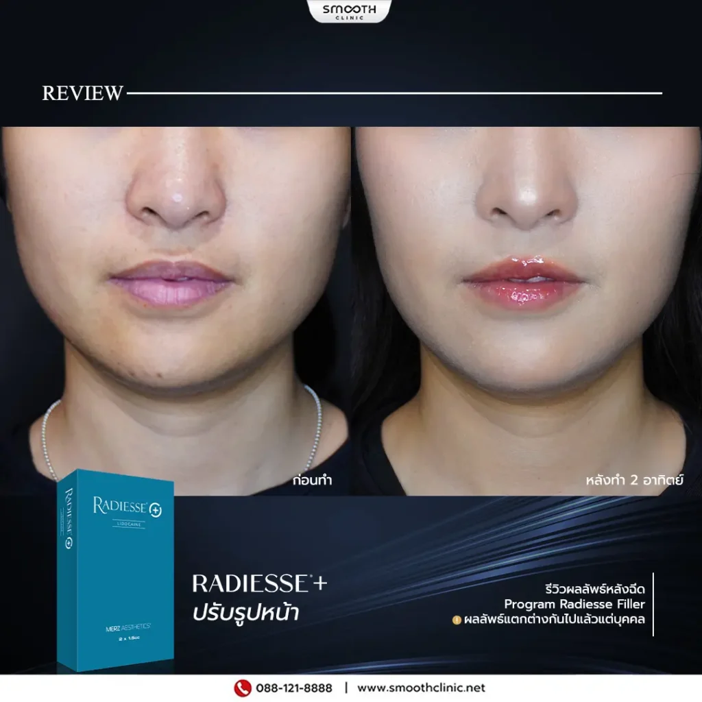 review q1 26 biostimulator 8