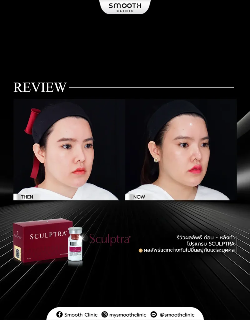 review q1 26 biostimulator 9