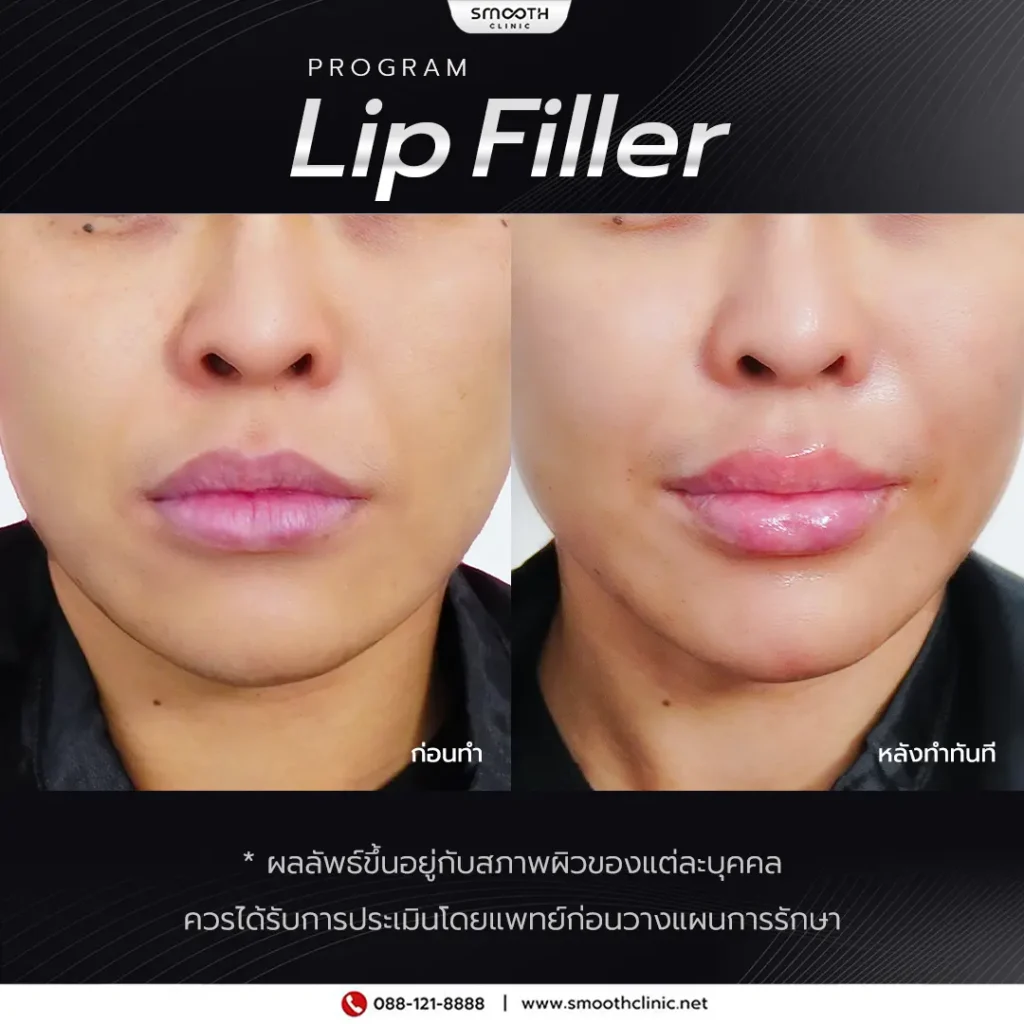 review q1 26 filler 1