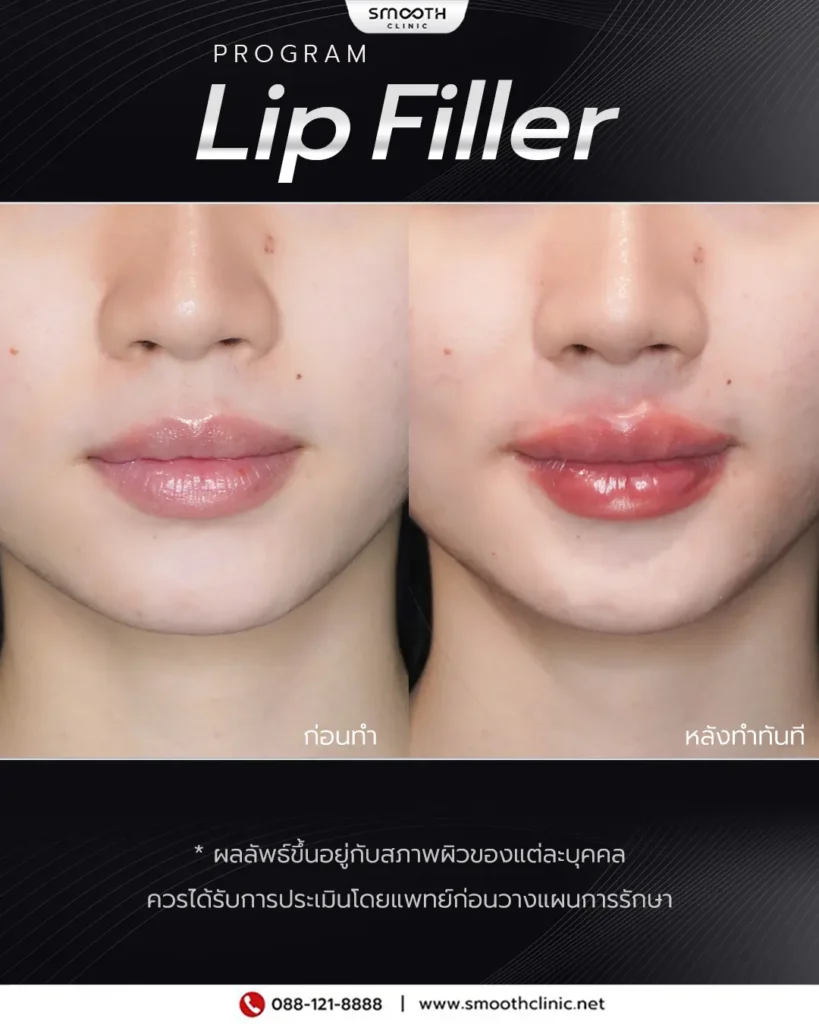 review q1 26 filler 10
