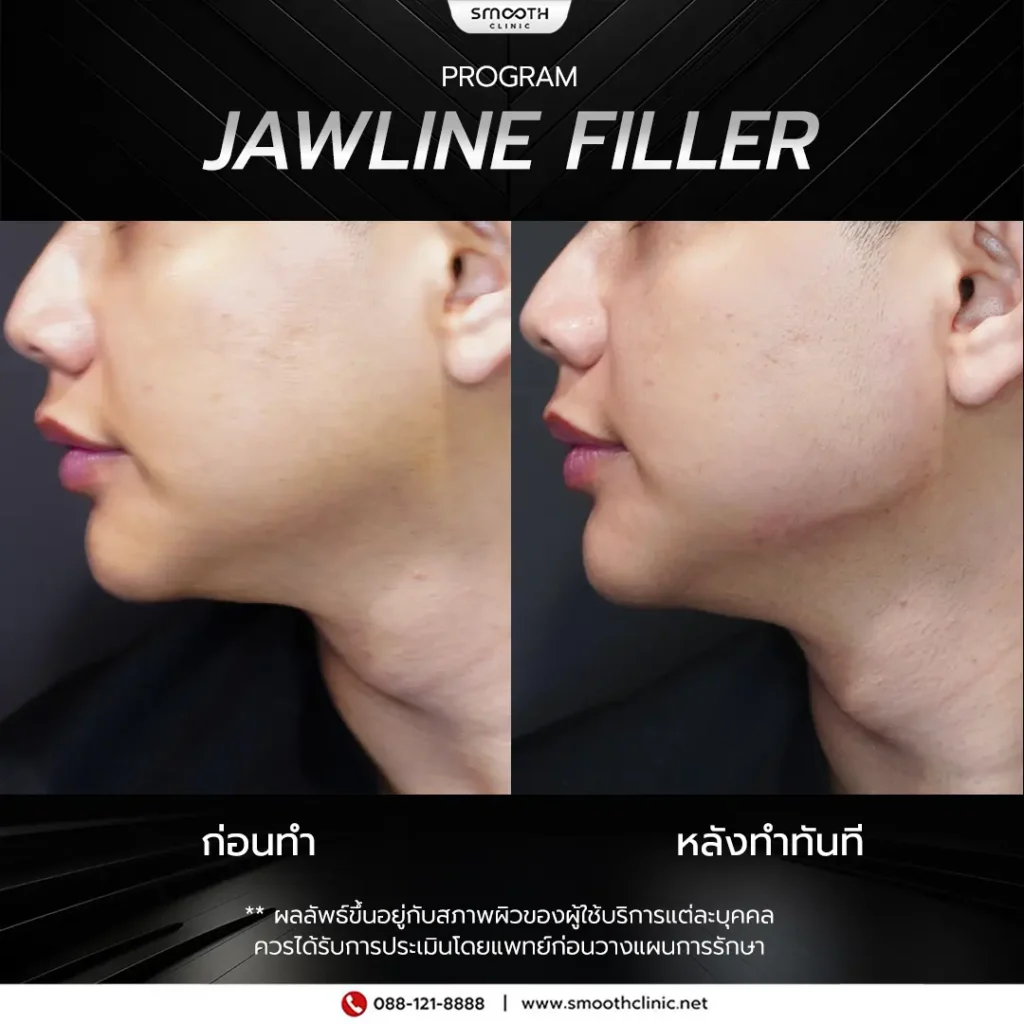 review q1 26 filler 2