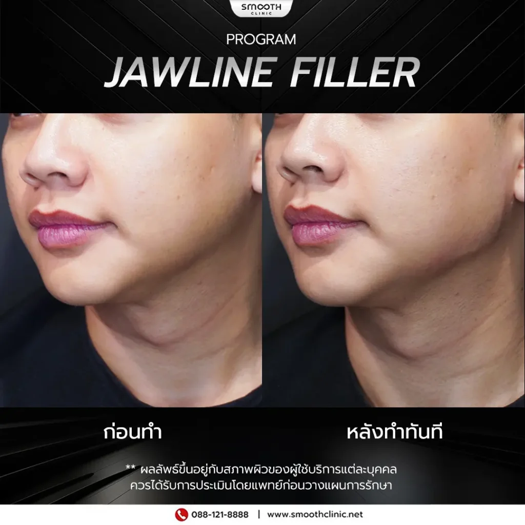 review q1 26 filler 3
