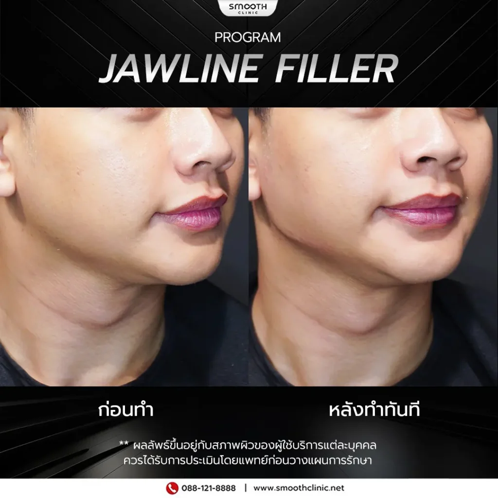 review q1 26 filler 4