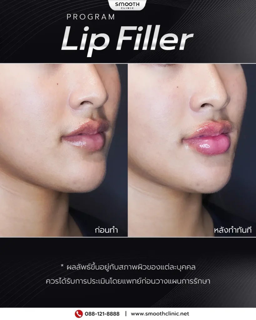 review q1 26 filler 5