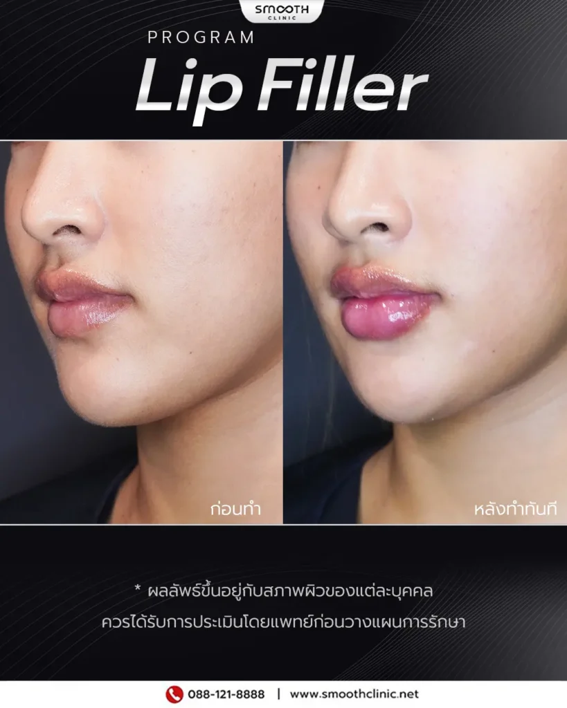 review q1 26 filler 6