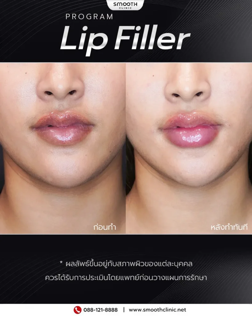 review q1 26 filler 7