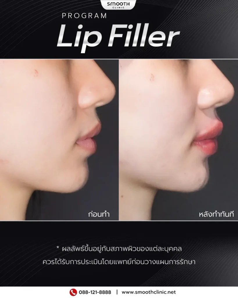 review q1 26 filler 8