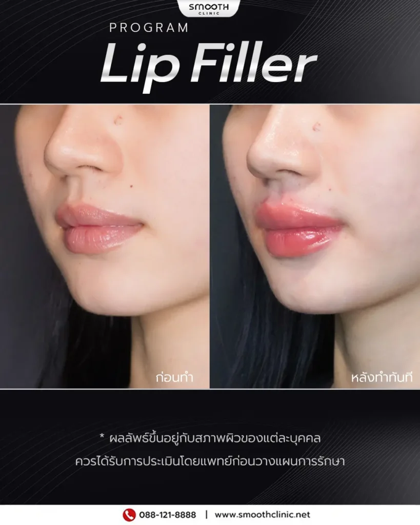 review q1 26 filler 9