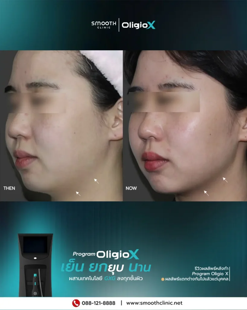 review q1 26 oligio x 1