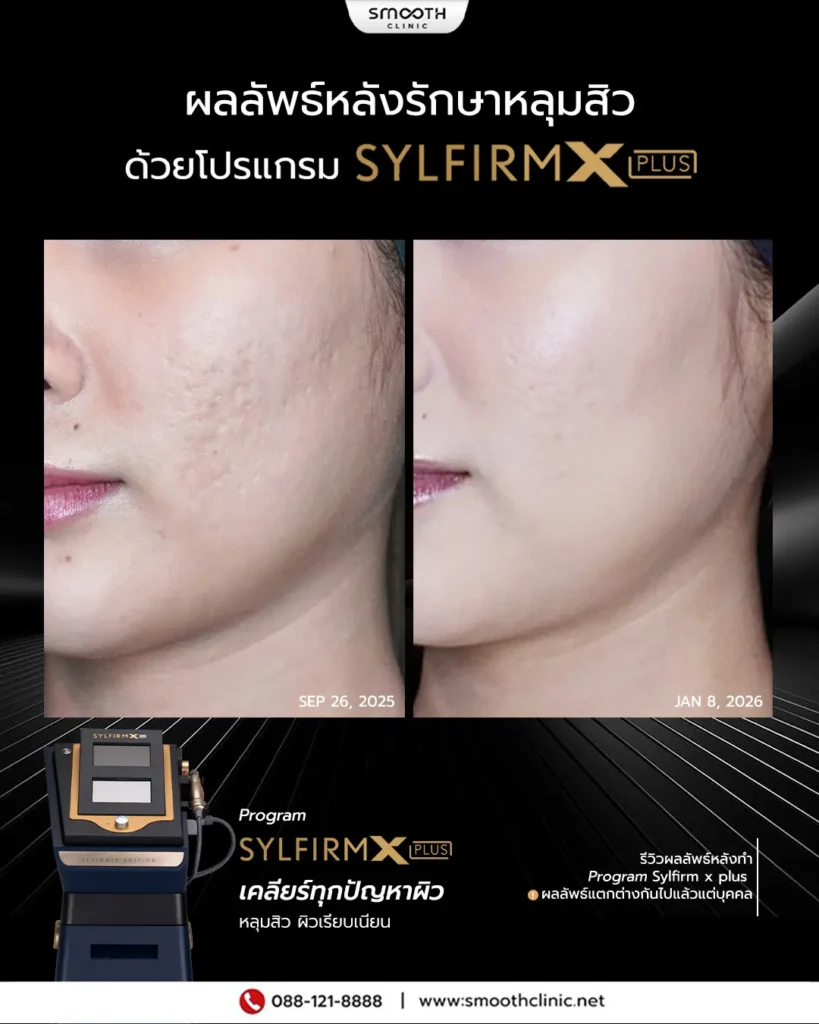 review q1 26 sylfirm x 10