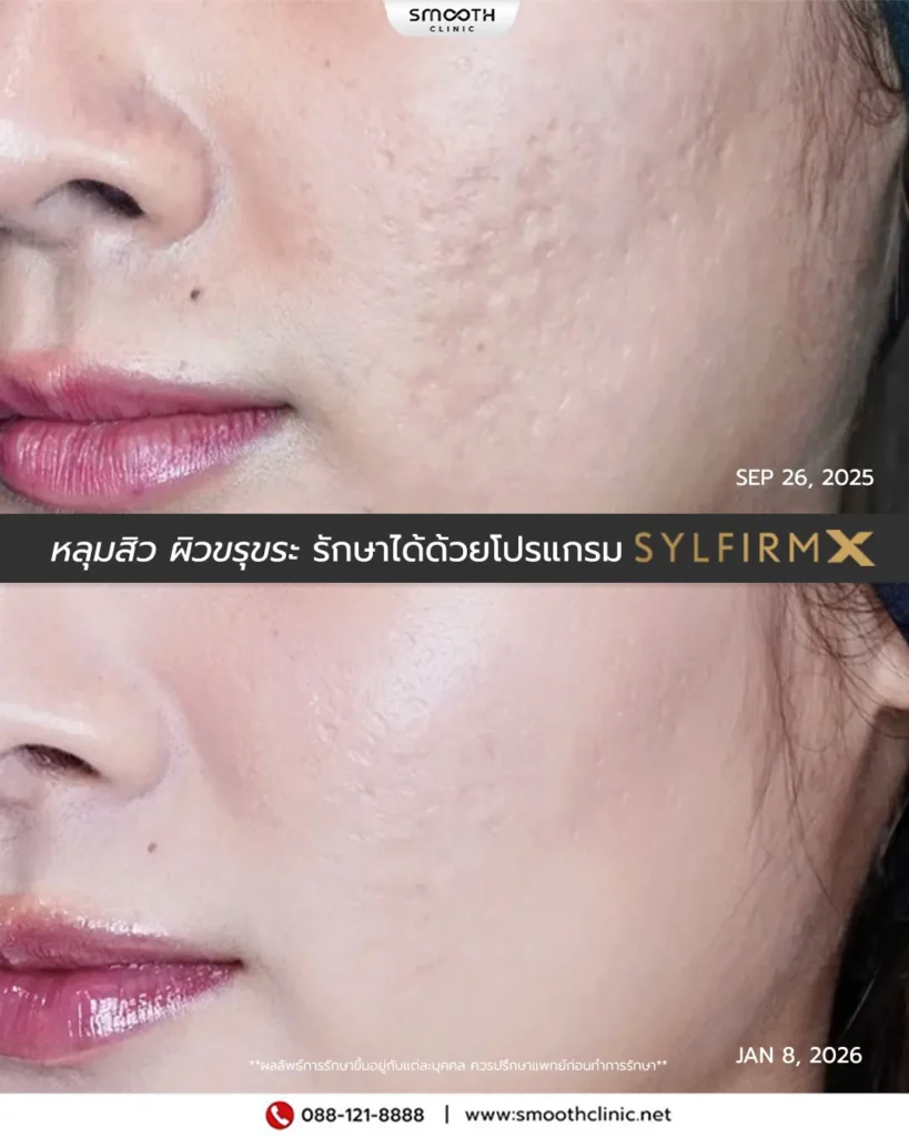 review q1 26 sylfirm x 11