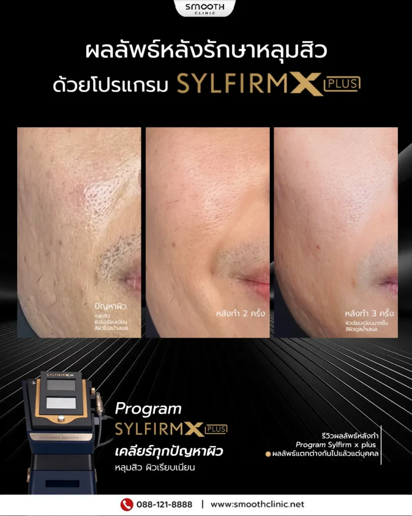 review q1 26 sylfirm x 2