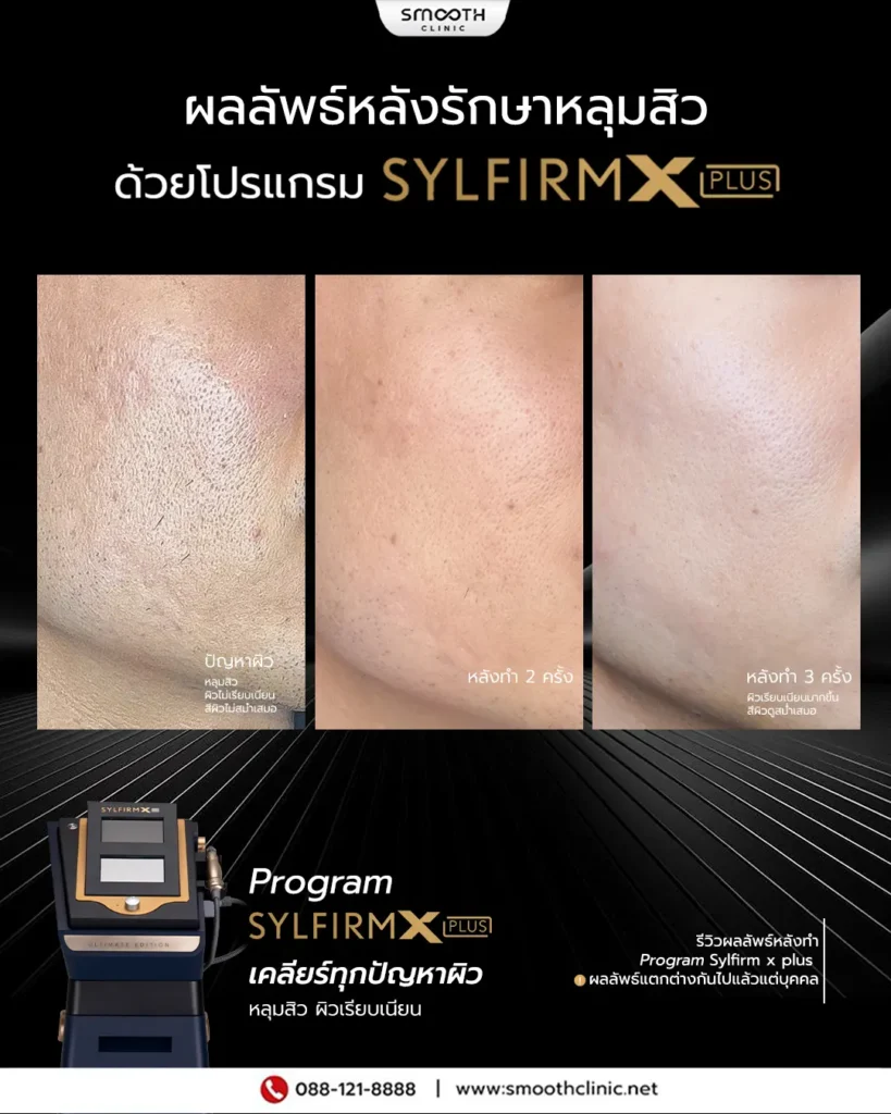 review q1 26 sylfirm x 4