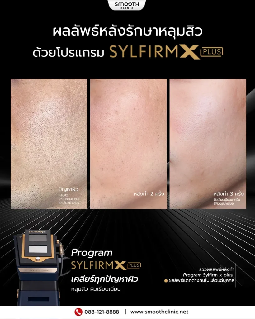 review q1 26 sylfirm x 6