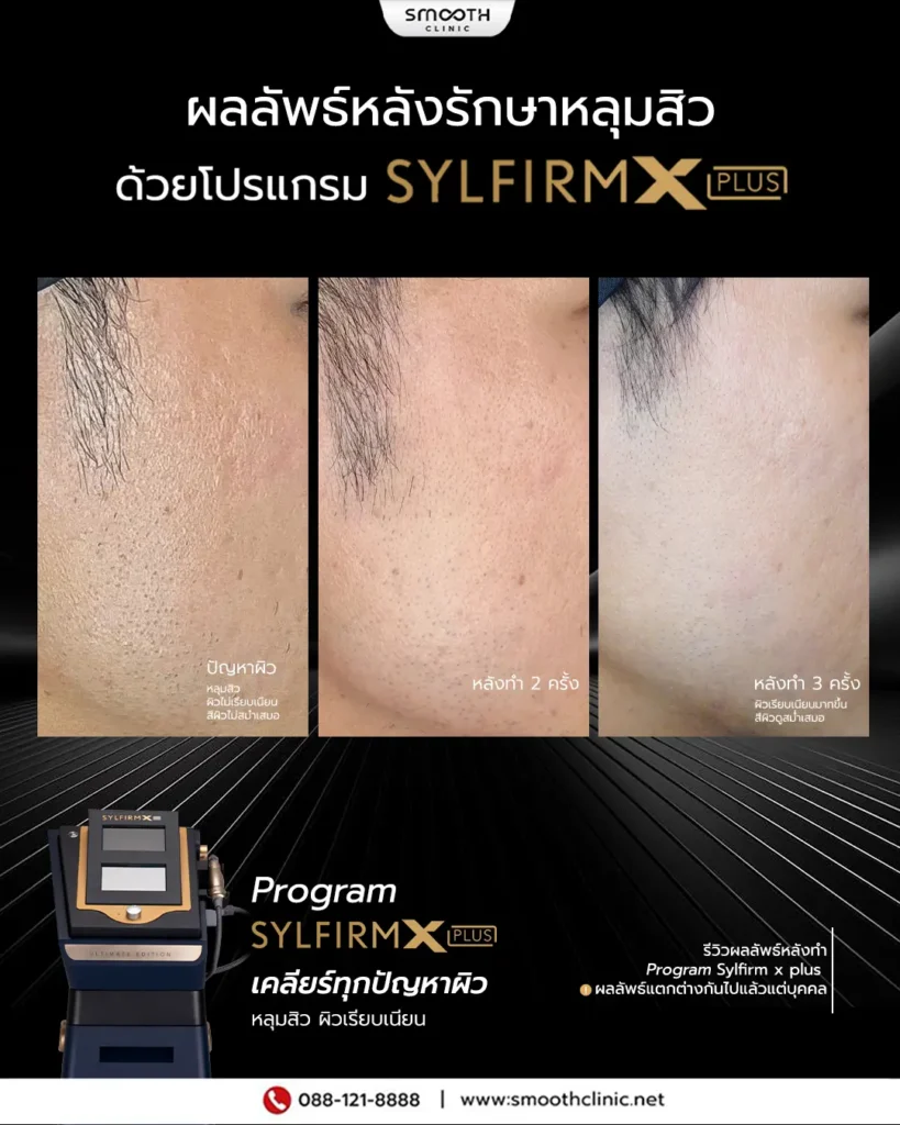 review q1 26 sylfirm x 8