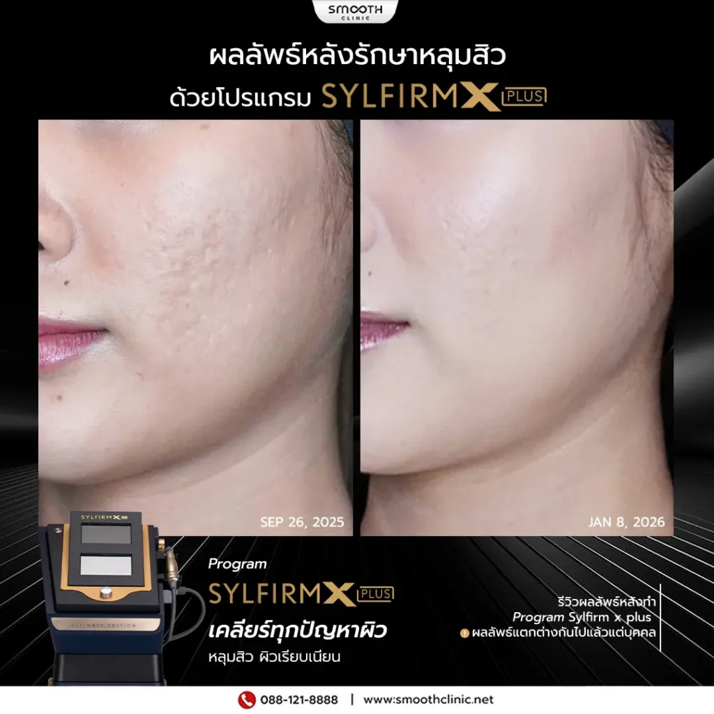 review q1 26 sylfirm x 9