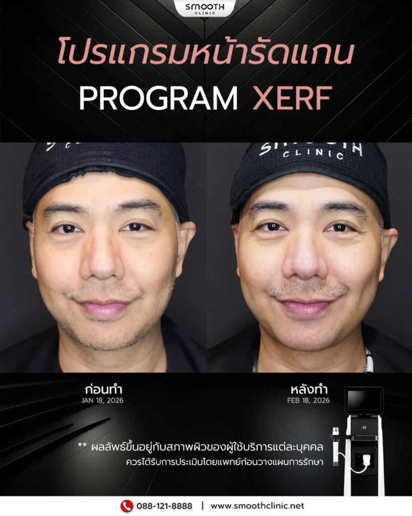 review q1 26 xerf 3
