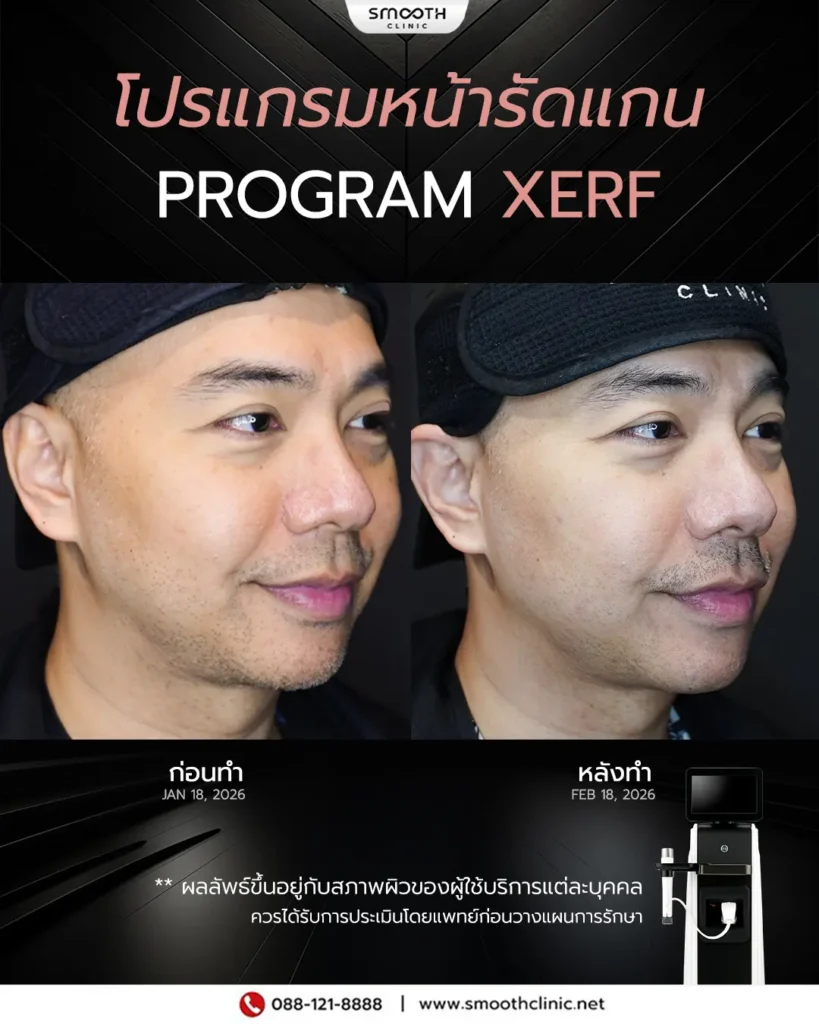 review q1 26 xerf 4