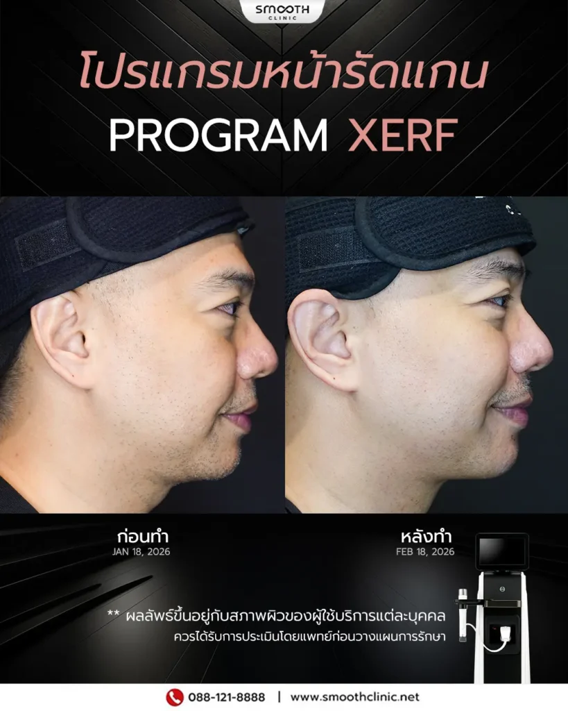 review q1 26 xerf 5