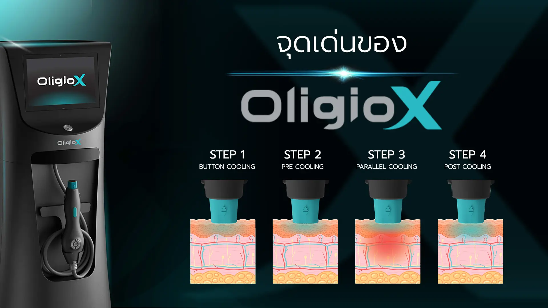 จุดเด่นของ Oligio X