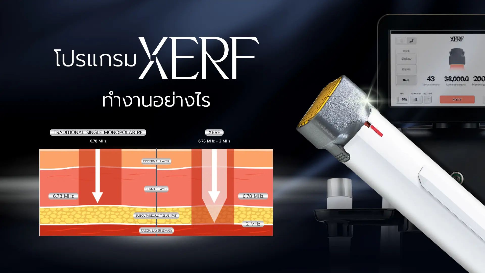 เทคโนโลยี XERF ทำงานอย่างไร